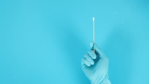 One,Cotton,Stick,In,Hand,With,Blue,Medical,Gloves,Or cheek swab test for sudden cardiac death in children